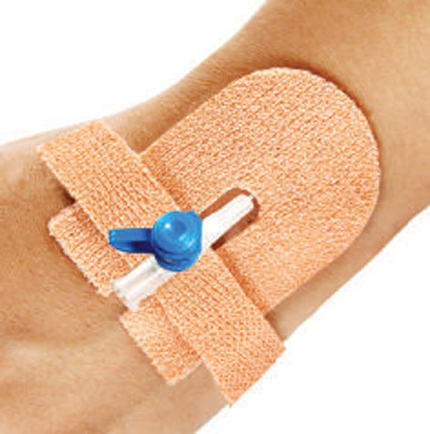 CANNULA FIXATOR
